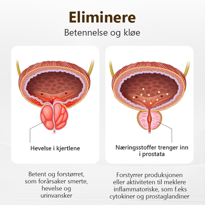 si farvel til ubehag i prostata🎈LEFUN™  Prostata Power Bee inhalasjonspinne🎈(Hurtigvirkende og langvarig)